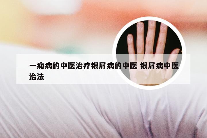 一痫病的中医治疗银屑病的中医 银屑病中医治法
