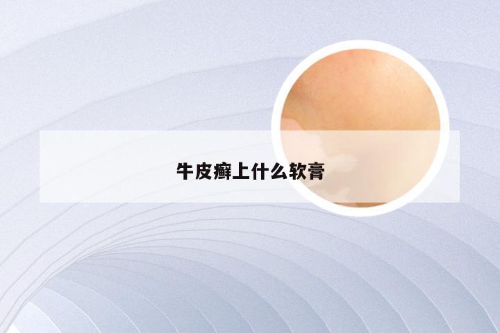 牛皮癣上什么软膏