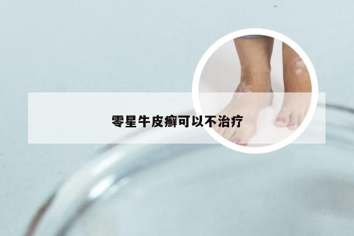 零星牛皮癣可以不治疗
