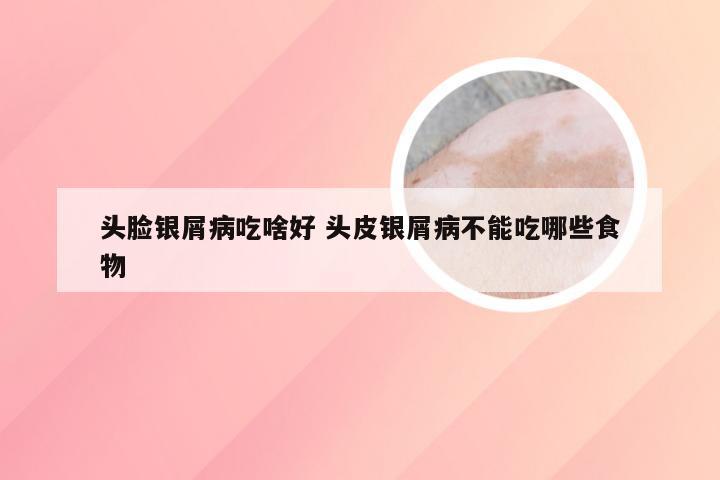 头脸银屑病吃啥好 头皮银屑病不能吃哪些食物