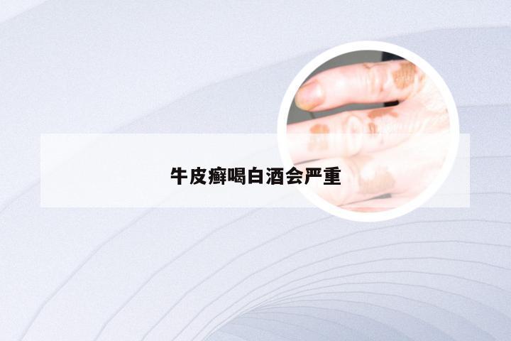 牛皮癣喝白酒会严重