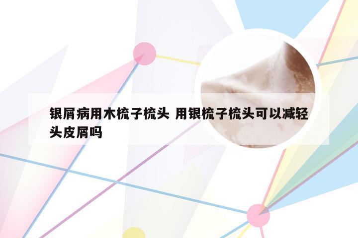 银屑病用木梳子梳头 用银梳子梳头可以减轻头皮屑吗