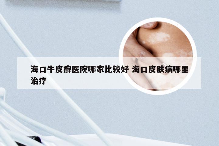 海口牛皮癣医院哪家比较好 海口皮肤病哪里治疗