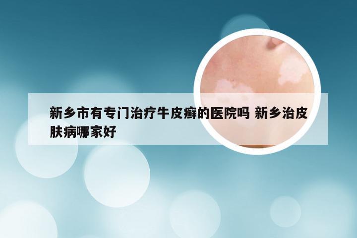 新乡市有专门治疗牛皮癣的医院吗 新乡治皮肤病哪家好