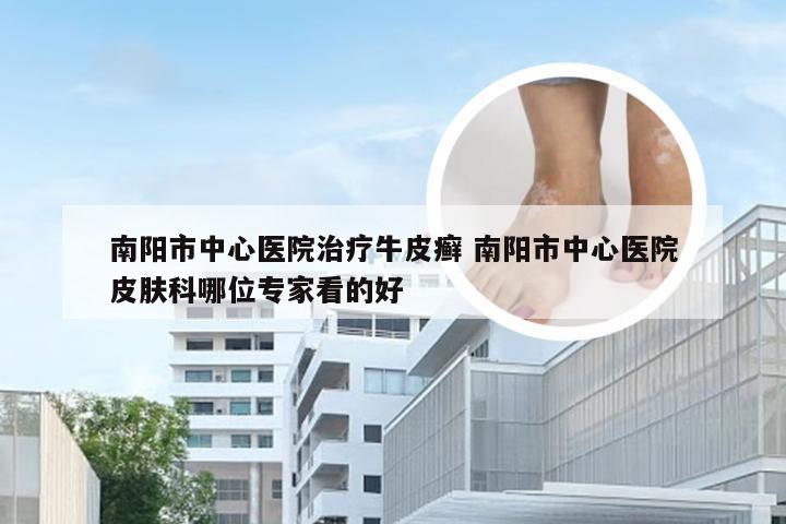 南阳市中心医院治疗牛皮癣 南阳市中心医院皮肤科哪位专家看的好