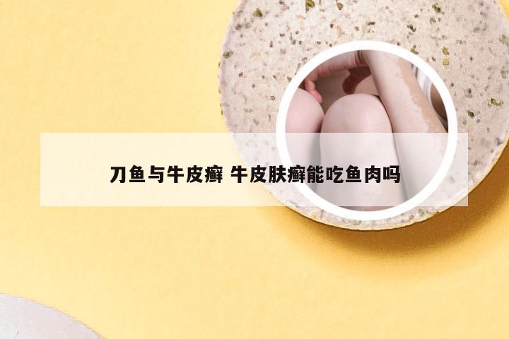 刀鱼与牛皮癣 牛皮肤癣能吃鱼肉吗
