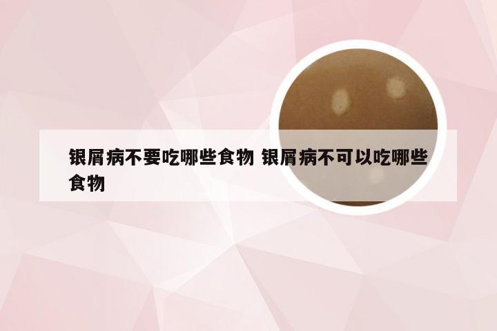 银屑病不要吃哪些食物 银屑病不可以吃哪些食物