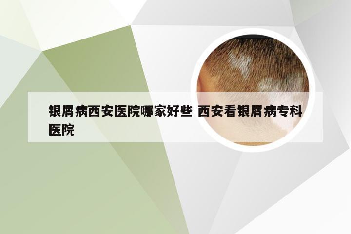 银屑病西安医院哪家好些 西安看银屑病专科医院