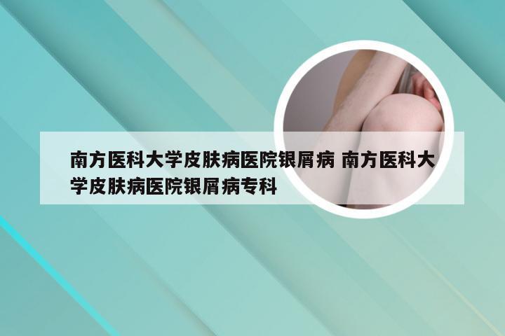 南方医科大学皮肤病医院银屑病 南方医科大学皮肤病医院银屑病专科