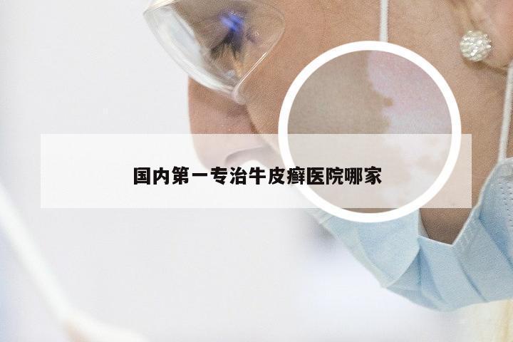 国内第一专治牛皮癣医院哪家