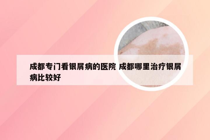 成都专门看银屑病的医院 成都哪里治疗银屑病比较好