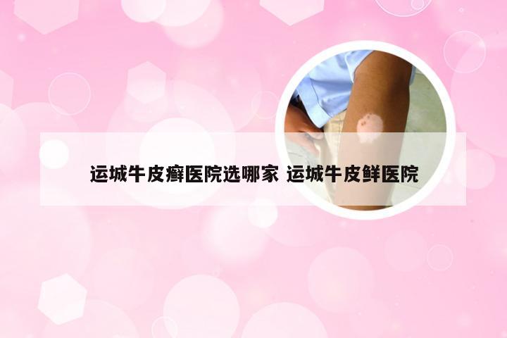 运城牛皮癣医院选哪家 运城牛皮鲜医院
