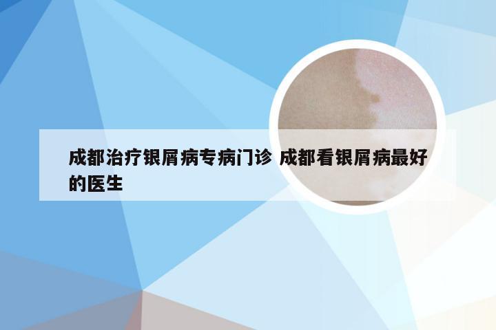成都治疗银屑病专病门诊 成都看银屑病最好的医生
