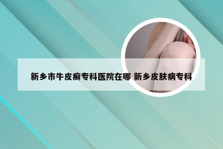 新乡市牛皮癣专科医院在哪 新乡皮肤病专科