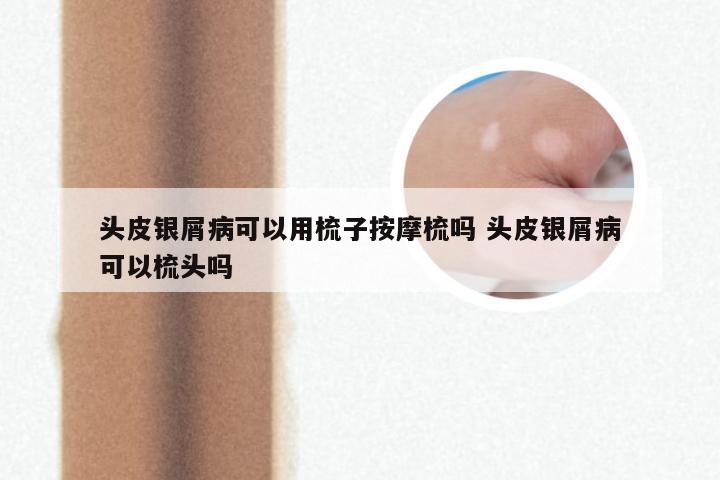 头皮银屑病可以用梳子按摩梳吗 头皮银屑病可以梳头吗