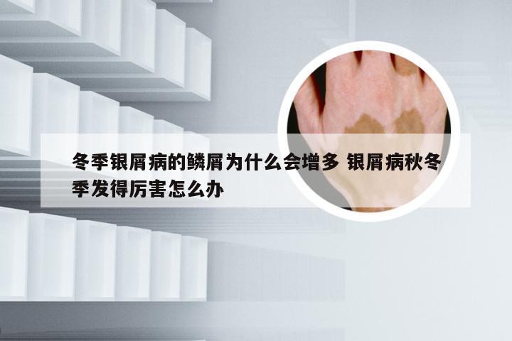 冬季银屑病的鳞屑为什么会增多 银屑病秋冬季发得厉害怎么办