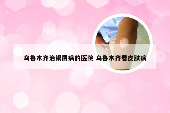 乌鲁木齐治银屑病的医院 乌鲁木齐看皮肤病