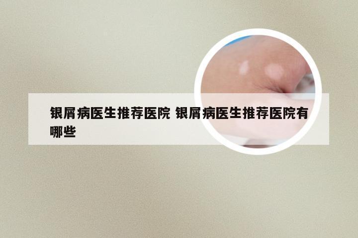 银屑病医生推荐医院 银屑病医生推荐医院有哪些