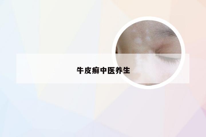 牛皮癣中医养生