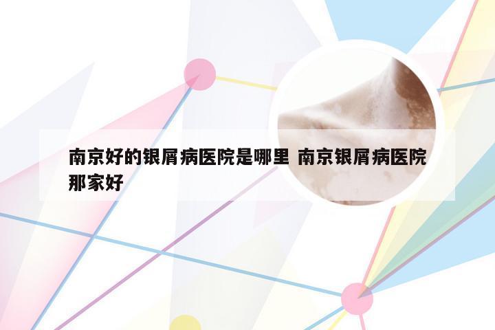 南京好的银屑病医院是哪里 南京银屑病医院那家好