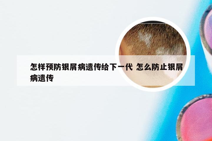 怎样预防银屑病遗传给下一代 怎么防止银屑病遗传