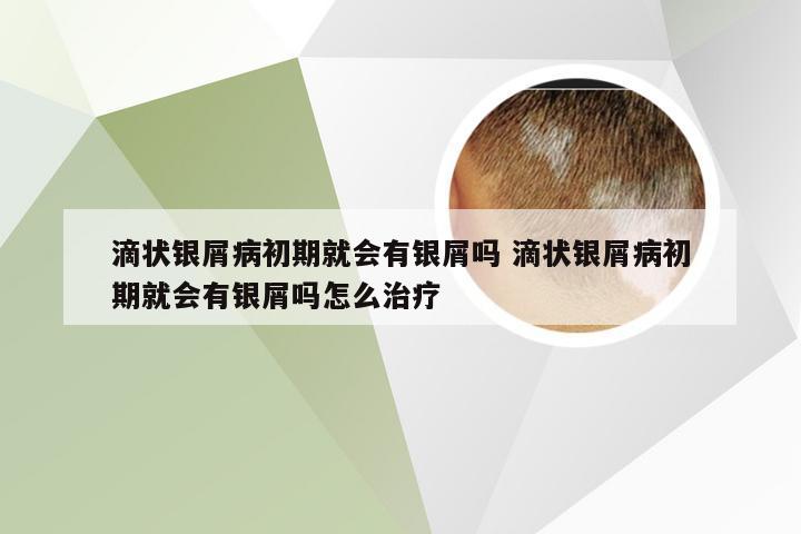 滴状银屑病初期就会有银屑吗 滴状银屑病初期就会有银屑吗怎么治疗