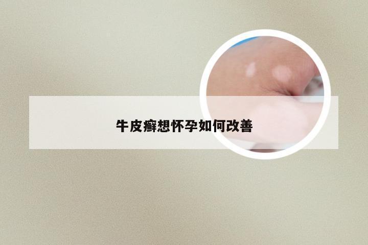 牛皮癣想怀孕如何改善