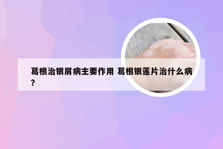 葛根治银屑病主要作用 葛根银莲片治什么病?
