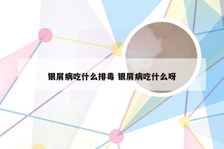 银屑病吃什么排毒 银屑病吃什么呀