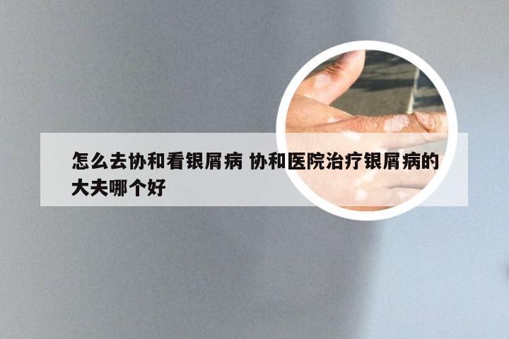 怎么去协和看银屑病 协和医院治疗银屑病的大夫哪个好