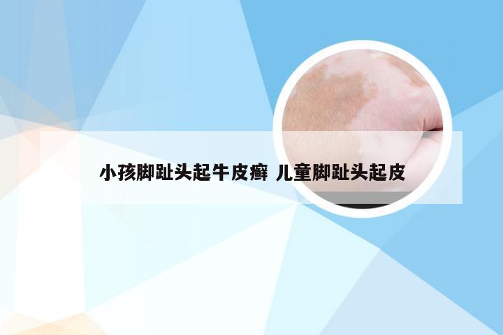 小孩脚趾头起牛皮癣 儿童脚趾头起皮