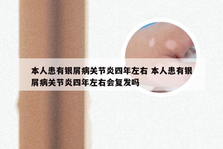 本人患有银屑病关节炎四年左右 本人患有银屑病关节炎四年左右会复发吗