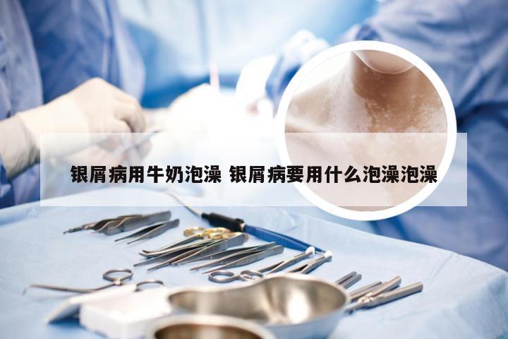 银屑病用牛奶泡澡 银屑病要用什么泡澡泡澡