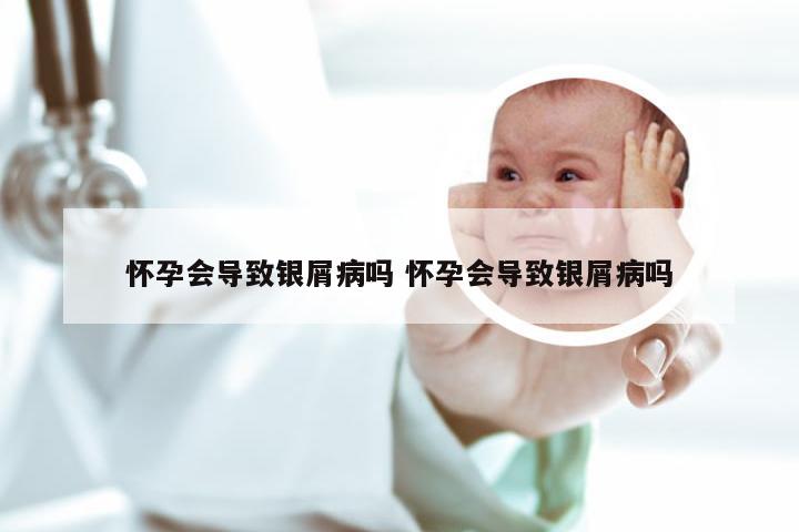 怀孕会导致银屑病吗 怀孕会导致银屑病吗