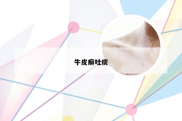 牛皮癣吐痰