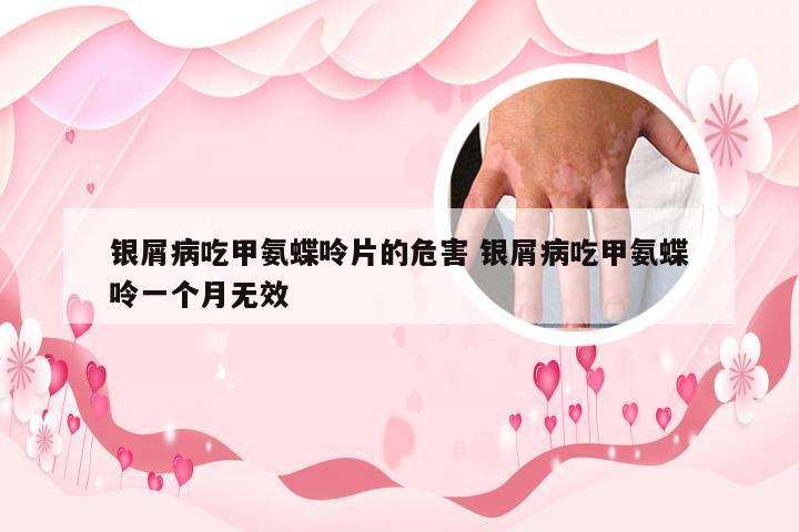 银屑病吃甲氨蝶呤片的危害 银屑病吃甲氨蝶呤一个月无效
