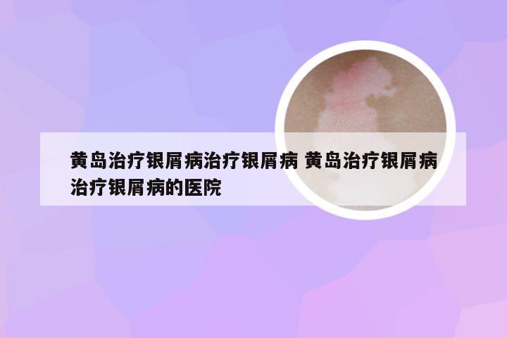 黄岛治疗银屑病治疗银屑病 黄岛治疗银屑病治疗银屑病的医院