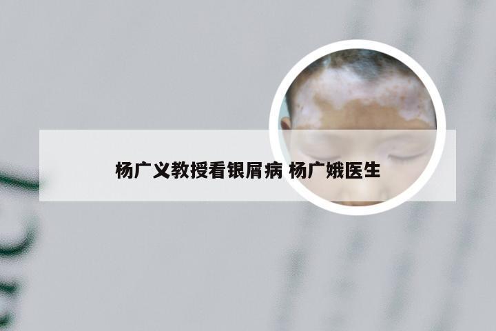杨广义教授看银屑病 杨广娥医生