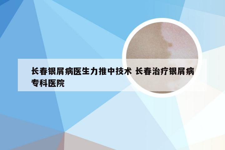 长春银屑病医生力推中技术 长春治疗银屑病专科医院