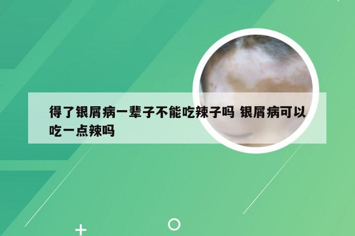 得了银屑病一辈子不能吃辣子吗 银屑病可以吃一点辣吗