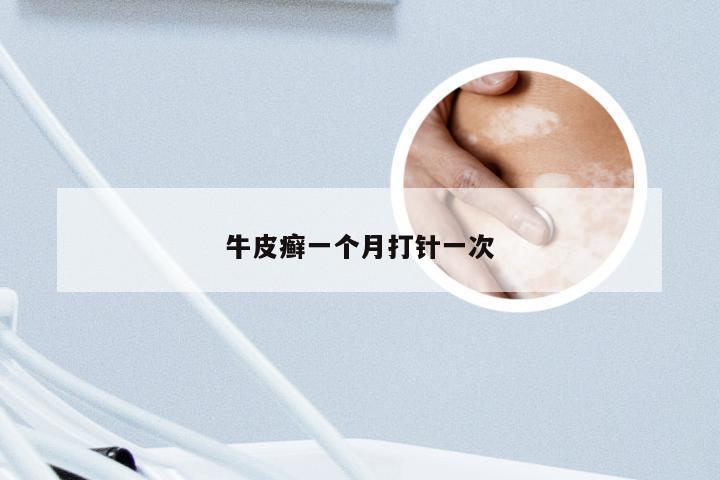 牛皮癣一个月打针一次