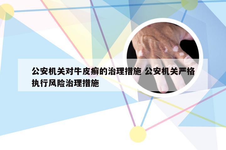 公安机关对牛皮癣的治理措施 公安机关严格执行风险治理措施