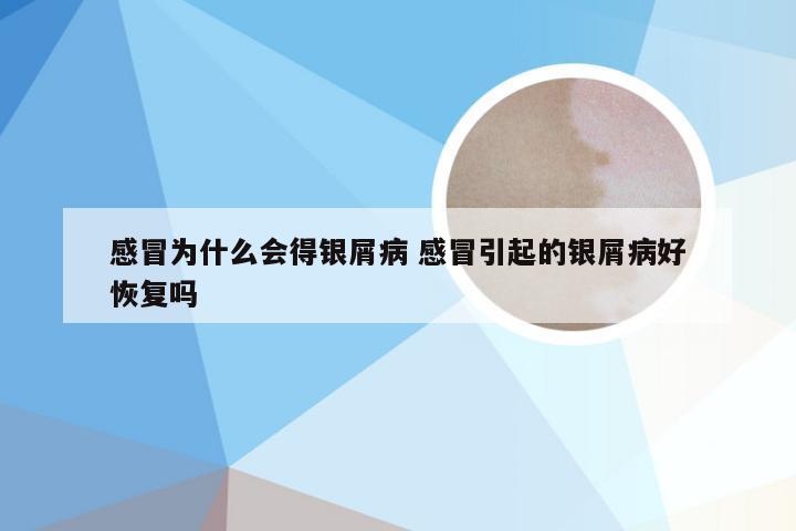 感冒为什么会得银屑病 感冒引起的银屑病好恢复吗