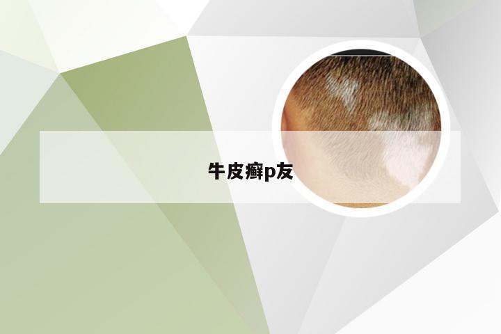 牛皮癣p友