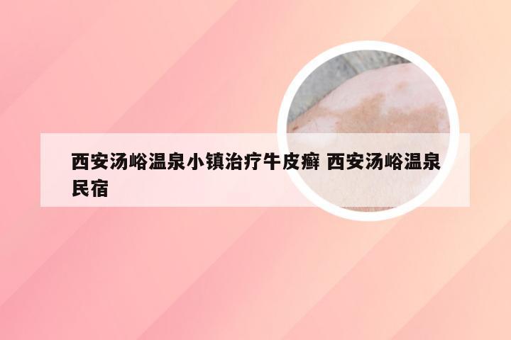 西安汤峪温泉小镇治疗牛皮癣 西安汤峪温泉民宿