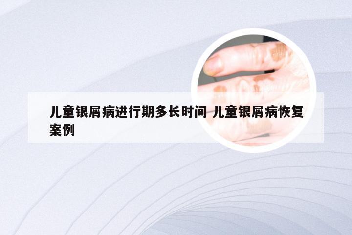 儿童银屑病进行期多长时间 儿童银屑病恢复案例