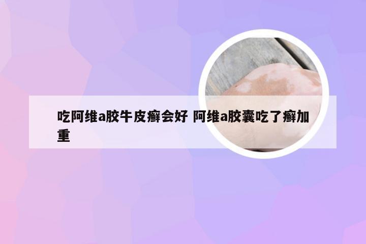 吃阿维a胶牛皮癣会好 阿维a胶囊吃了癣加重