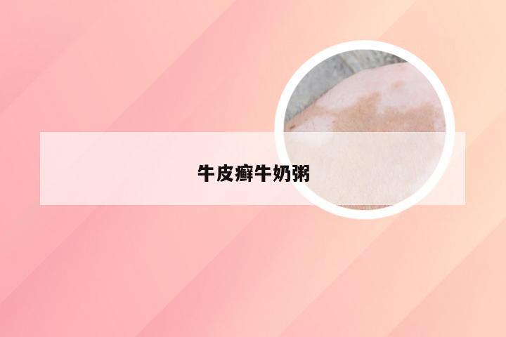 牛皮癣牛奶粥