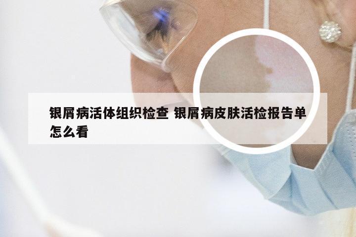 银屑病活体组织检查 银屑病皮肤活检报告单怎么看