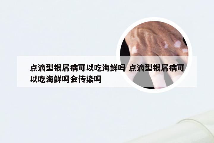 点滴型银屑病可以吃海鲜吗 点滴型银屑病可以吃海鲜吗会传染吗